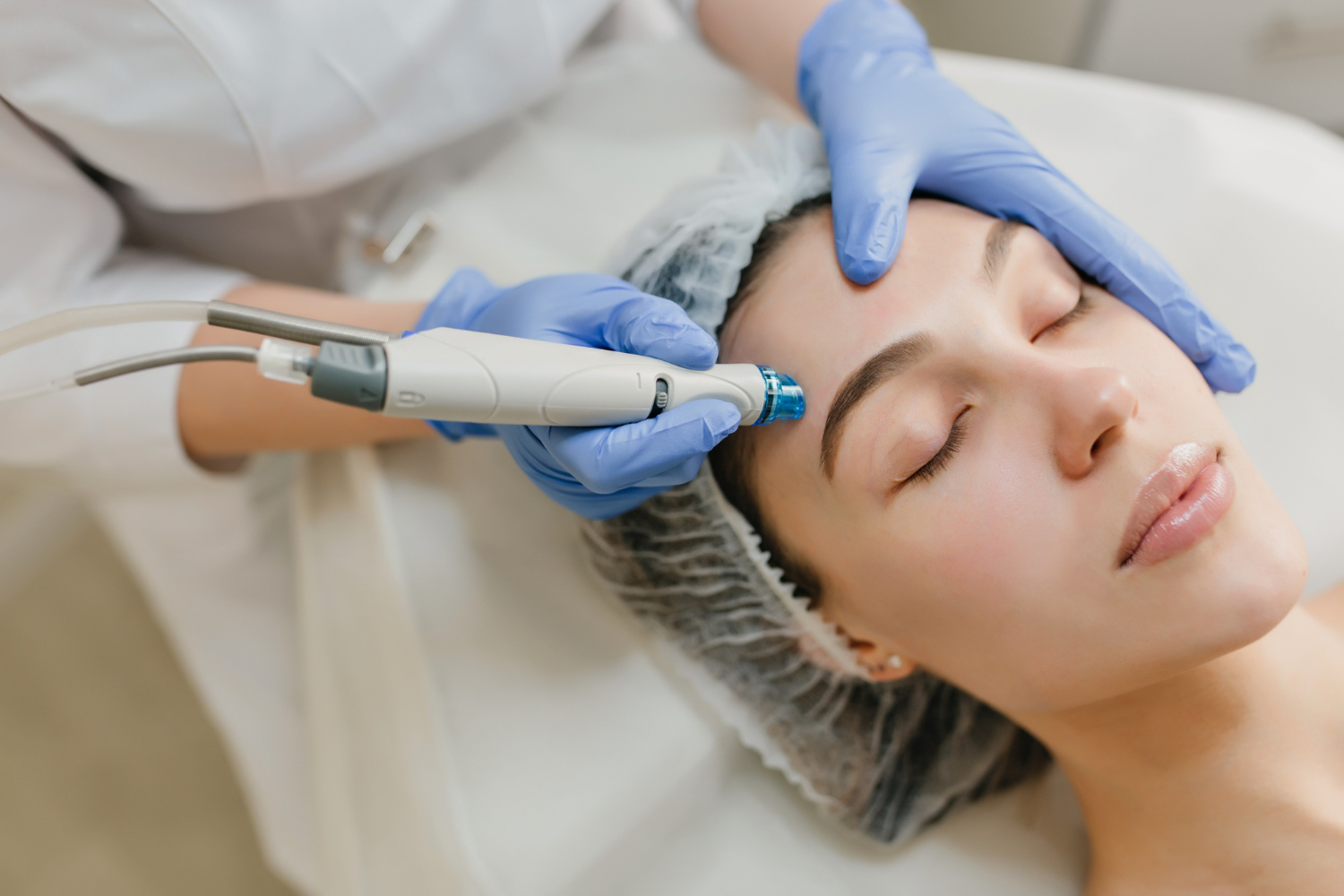 Microneedling & PRP treatment